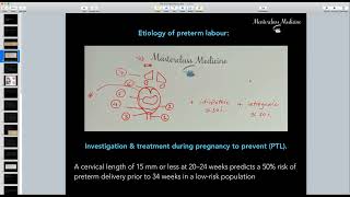 Preterm Labour  OB course  Masterclass Medicine [upl. by Karin]