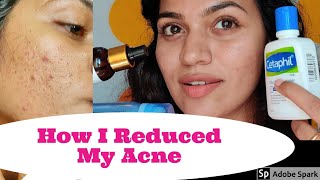 Updated SkincareDermat recommended face wash എന്റെ Oily Skin Acne prone skincare routine [upl. by Anuahc104]