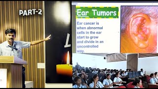 Tumors of The Ear Part2  External Ear Tumors [upl. by Nnylylloh]