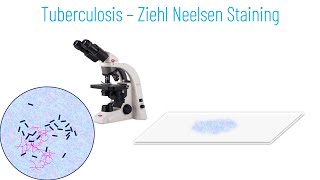 Ziehl Neelsen Staining Principle and Procedure [upl. by Onez317]