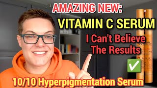 ULTIMATE HYPERPIGMENTATION SERUM  Next Level Korean Skincare Vitamin C [upl. by Burtie]