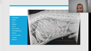 Chapter 6 Lets study X rays 13 الجدPeritonealamp retroperitoneal free fluid amp gas سوائل هواء البطن [upl. by Annanhoj]