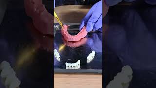 Digital Denture ASMR digitaldentistry digitaldentures [upl. by Saticilef]