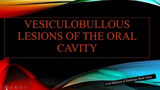 Vesiculobullous lesions of the oral cavity Introduction amp Classification [upl. by Kcirb]