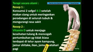 Punggung bambu ankylosing spondylitis [upl. by Morville]