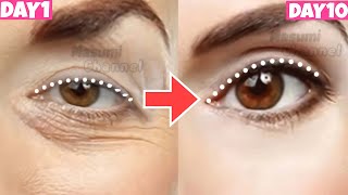 Eye Lift Exercise Get Bigger Eyes Prevent Droopy Eyelids Sagging Eyelids Massage YOU MUST DO [upl. by Dulsea]