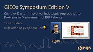 Innovative Endoscopic Approaches to Problems in Management of IBD Patients Taster video [upl. by Reyna944]