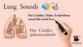 Fine Crackles  Fine Crepitations  Fine Rales  Lung sounds [upl. by Nosrettap]