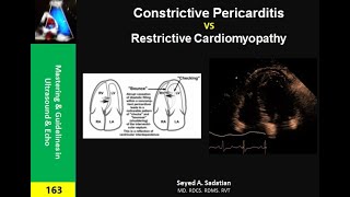 Constrictive Pericarditis vs Restrictive Cardiomyopathy [upl. by Jos]