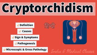 Cryptorchidism  Pathology  Microscopic and Gross Pathology  Pathogenesis [upl. by Docia]