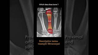 Descriptive terms example 3 Metacarpal Musculoskeletal Xray Quiz anatomy radiologychannel007 [upl. by Dachia]