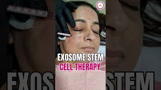 Exosome Stem Cell Therapy acne antiaging beauty cleanbeauty dryskinglowingskin healthyskin [upl. by Nuy]