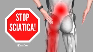 How to Relieve Sciatica Pain in SECONDS [upl. by Noryd]