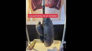 Pulmones de fumador [upl. by Bardo484]