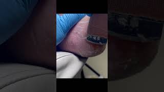 Charming Pedicure Video  Remove Dead Skin [upl. by Ainosal]