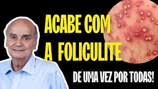 A MELHOR MANEIRA DE ACABAR COM A FOLICULITE DE UMA VEZ POR TODAS SAIBA NESSE VÍDEO [upl. by Minnaminnie82]