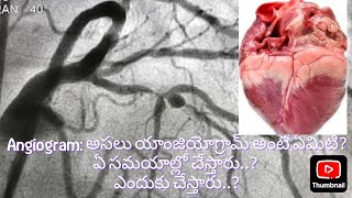 కరోనరీ యాంజియోగ్రామ్ ఎందుకు చేస్తారుCoronary angiogramCardio vascular invasive procedure [upl. by Purdy]