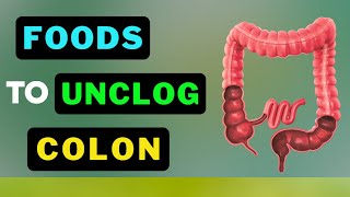 From Clogged to Clean Top Secret Colon Detoxifiers Revealed [upl. by Nnairac292]