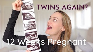 12 WEEKS PREGNANT 2 SETS OF TWINS ULTRASOUND  My Signs amp Symptoms  Pregnancy Update [upl. by Girhiny]