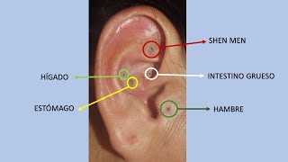 Auriculoterapia para Bajar de Peso ¿Cómo funciona Dr Ricardo Vargas H [upl. by Bouzoun]