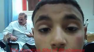 Chronic Progressive External Ophthalmoplegia  شلل عضلات العين [upl. by Lehteb408]