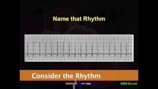 Intro EKG Interpretation Part 2 [upl. by Airehtfele]