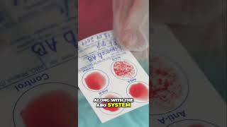 Human Rh Blood Factor Type Explained health hospital sickness diseases [upl. by Air]