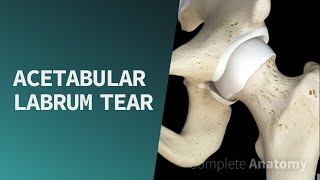 Acetabular Labrum Tear  Pathologies [upl. by Armand]