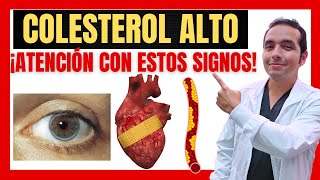 🔴 SIGNOS Y SÍNTOMAS DE COLESTEROL ALTO 🧈🍔🍟 [upl. by Nibla489]