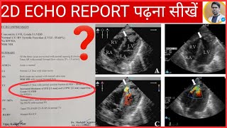 2D ECHO REPORT कैसे पढ़ते हैं2D ECHO REPORT मैं क्या क्या लिखा होता है2D ECHO दिल की जांच रिपोर्ट [upl. by Brose]