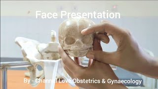 Face Presentation Labour Mechanism amp Management LoveObsGynae [upl. by Ryhpez]