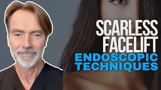 Scarless Facelift Discover Advanced Endoscopic Techniques [upl. by Dominy]