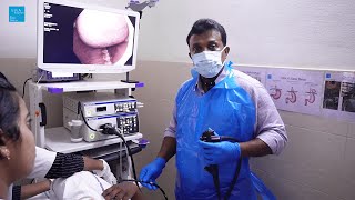 Upper GI Endoscopy Procedure by Dr Sivakumar [upl. by Bayard814]