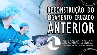 RECONSTRUÇÃO DO LIGAMENTO CRUZADO ANTERIOR  Dr Adriano Leonardi [upl. by Strenta]