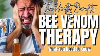 The Surprising Health Benefits of Bee Venom Therapy [upl. by Barbur993]