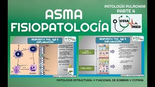 ASMA BRONQUIAL FISIOPATOLOGÍA  GuiaMed [upl. by Nyrhtac]