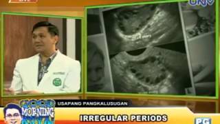 Usapang Pangkalusugan  Irregular Periods July 17 2013 [upl. by Relyuc127]