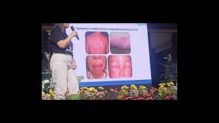 The Medical City Forum  ALLERGIES  National Allergy Day • Ortigas Ave Pasig City Philippines [upl. by Aeneas567]