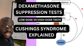 DEXAMETHASONE SUPPRESSION TESTS EXPLAINED  CUSHING SYNDROME  MEDICINE [upl. by Edris133]