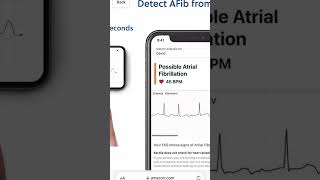 YOUR PORTABLE EKG COMPANION  KARDIAMOBILE 1  AMAZON FINDS ❤️ [upl. by Enihsnus]