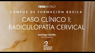 Caso clínico con NESA® Radiculopatía cervical Dr Santiago Garfias neurocirujano Ft NESA WORLD® [upl. by Reldnahc]