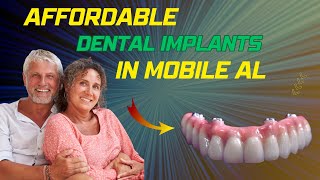 Full Mouth Dental Implants Mobile AL 251 3123030 Cost of Dental Implants Mobile [upl. by Marius]