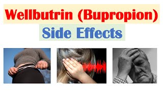 Wellbutrin Bupropion Side Effects To Watch Out For amp Why They Occur [upl. by Erej]