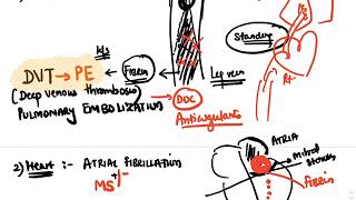 Hematology  AntiCoagulants [upl. by Dleifxam]