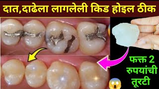 घरातील फक्त 2 वस्तू वापरा दातांन संबंधित सर्व समस्या दूर होतील😱 kitchen tips  home remedies  teeth [upl. by Ahseya995]