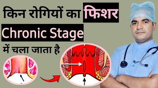 Chronic Fissure kaise banta hai  fissure treatment  fissure treatment in hindi  fissure surgery [upl. by Cacie]