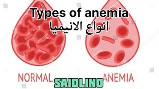 انواع الأنيميا شرح للطاقم الطبي Types of anemia [upl. by Ialocin683]