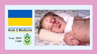 Krok 2 Medicine  Year 2019  049 Ministry of Public Health of Ukraine [upl. by Brier]