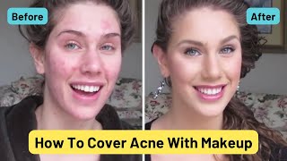 3 SPFs for acne prone oily skin  best sunscreens that are acne friendly Murad SLMD Face Reality [upl. by Dyane]