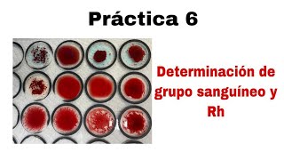 Práctica 6 Determinación de grupo sanguíneo y Rh [upl. by Ploss517]